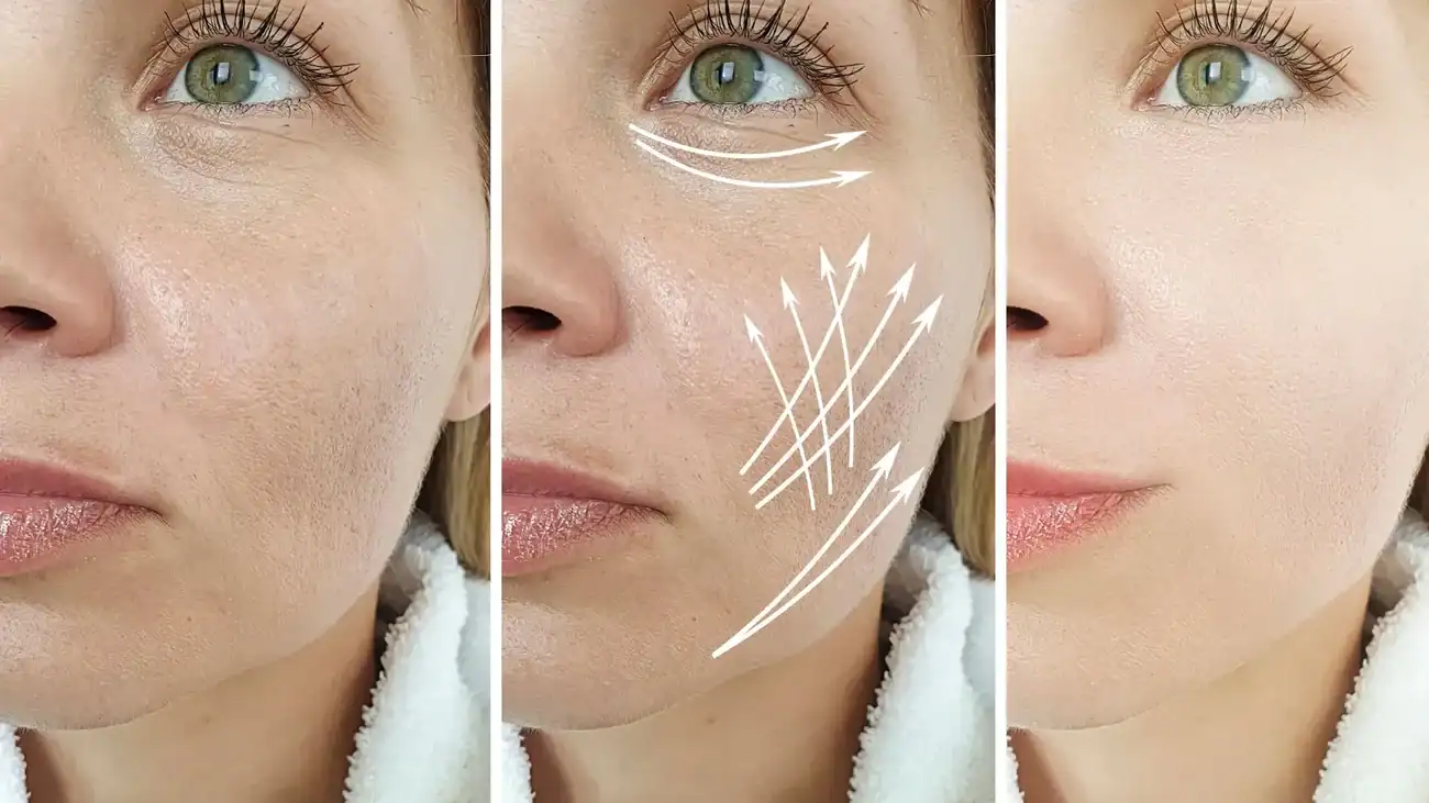 Can One Treatment Really Tackle More Than One Skin Concern Taunton?