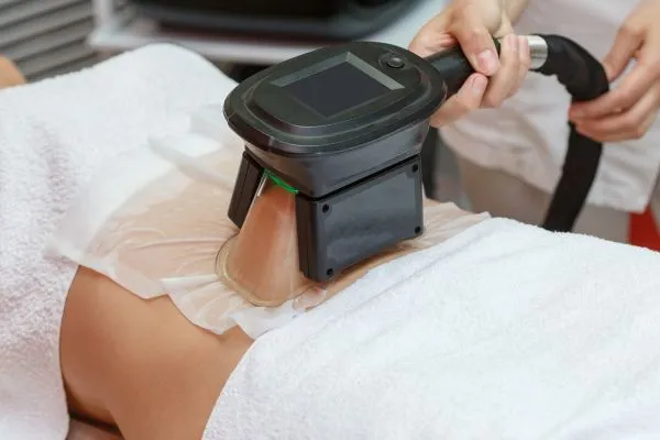 Image of person having fat freezing treatment to help weight gain Taunton