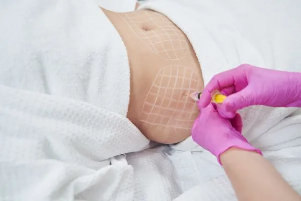 image of fat dissolving injections on love handles to help combat weight gain Taunton