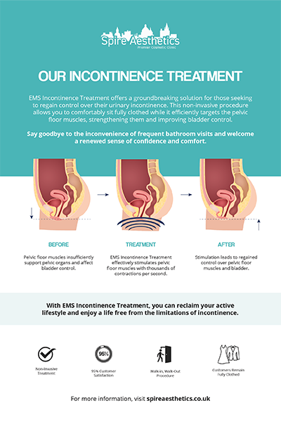 image to show how EMS treatment works for female urinary incontinence Taunton