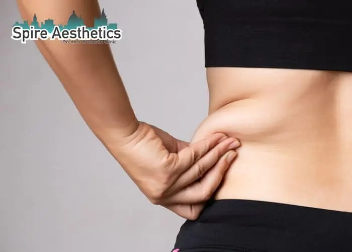 Image of woman pinching fat on their hips Taunton. Fat Freezing treatment