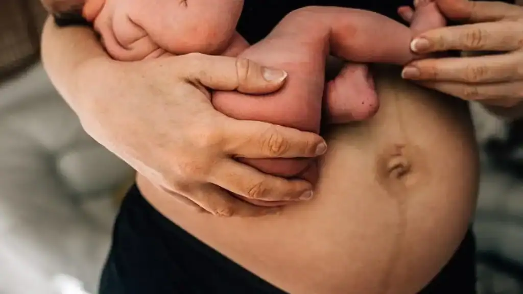Why Is My Stomach Still Big After Pregnancy Taunton?
